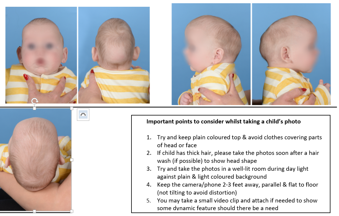 Carniofacial images of infant